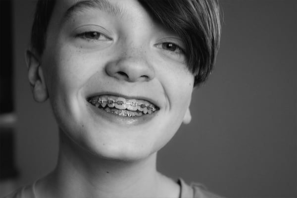 Young boy smiling at the camera, wearing metal braces on his teeth, black and white portrait