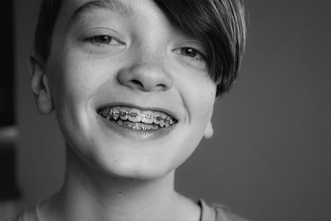 Young boy smiling at the camera, wearing metal braces on his teeth, black and white portrait